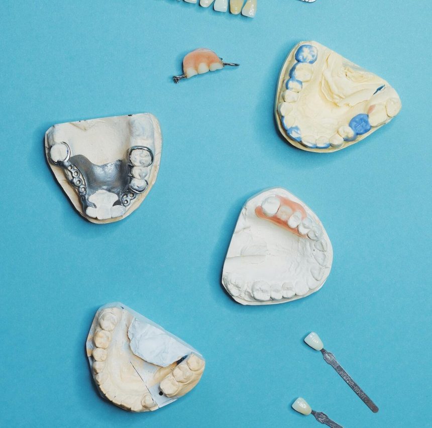 Dlaczego implanty zębowe są lepszym rozwiązaniem od protez?